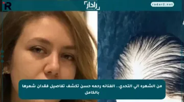 من الشهرة إلى التحدي.. الفنانة رحمة حسن تكشف تفاصيل فقدان شعرها بالكامل